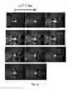Fig. 10 - MODELS FOR PARKINSON'S DISEASE STUDIES