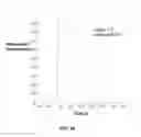 Fig. 19 - MODELS FOR PARKINSON'S DISEASE STUDIES