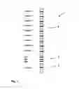 Fig. 02 - CALIBRATION STRIP FOR AN IMMUNOBLOT