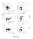 Fig. 11 - NON-B-LINEAGE CELLS CAPABLE OF PRODUCING ANTIBODY