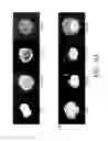 Fig. 30 - NON-B-LINEAGE CELLS CAPABLE OF PRODUCING ANTIBODY