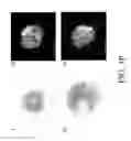Fig. 31 - NON-B-LINEAGE CELLS CAPABLE OF PRODUCING ANTIBODY