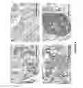 Fig. 08 - B7-H3 AS A BIOMARKER FOR DIAGNOSING THE PROGRESSION AND EARLY LYMPH NODE METASTASIS OF CANCER