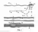 Fig. 02 - Sensor assembly
