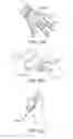 Fig. 35 - Running object recognizers in a passable world model for augmented or virtual reality
