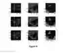 Fig. 07 - AUTHENTICATION METHOD USING MULTI-FACTOR EYE GAZE