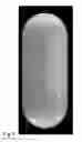Fig. 09 - Automated pharmaceutical pill identification