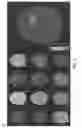 Fig. 06 - System and method of automatically detecting tissue abnormalities
