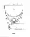 Fig. 08 - Playing aid for a stringed instrument