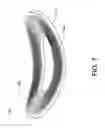Fig. 08 - Induction coil having a conductive winding formed on a surface of a molded substrate