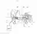 Fig. 02 - Earphone assembly with moisture resistance