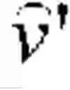 Fig. 02 - Own voice shaping in a hearing instrument
