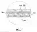 Fig. 09 - Catheter With Inner Surface Pressure Sensor for Providing a Vascular Pressure Measurement for Determining Fractional Flow Reserve