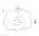 Fig. 06 - MULTI-MODALITY BREAST CANCER TEST SYSTEM