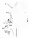 Fig. 09 - Image formation apparatus and method for nuclear imaging