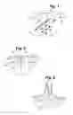 Fig. 02 - Method and apparatus for wound closure with sequential tissue positioning and retention