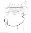 Fig. 01 - Tissue Compression Device with Deflecting Pressure Element