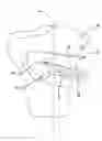 Fig. 01 - HTO guide with optional guided ACL/PCL tunnels