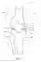 Fig. 02 - Instrumentation for knee resection