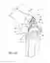 Fig. 07 - Instrumentation for knee resection
