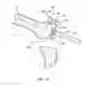 Fig. 09 - Instrumentation for knee resection