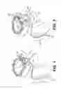 Fig. 02 - Tissue extraction devices and related methods