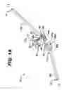 Fig. 02 - Adjustable-angle spinal fixation element
