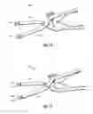 Fig. 09 - Compression plate kit and methods for repairing bone discontinuities