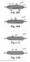 Fig. 08 - Implants, tools, and methods for treatments of pelvic conditions
