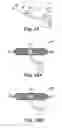 Fig. 09 - Implants, tools, and methods for treatments of pelvic conditions
