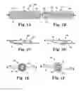 Fig. 02 - Implants, tools, and methods for treatments of pelvic conditions
