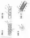 Fig. 09 - PROSTHESIS INTERSOMATIC OF LUMBAR AND SACRAL FUSION APPLIED IN THE PATHOLOGY TREATMENT OF SAGITTAL MISALIGNMENT TYPE