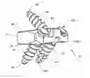Fig. 01 - Spinal implant with attachment system