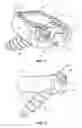 Fig. 02 - Spinal implant with attachment system