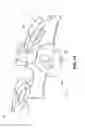 Fig. 06 - Spinal implant with attachment system