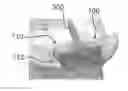 Fig. 01 - Expandable intervertebral implant