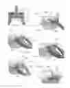 Fig. 06 - Expandable intervertebral implant