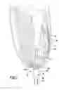 Fig. 02 - Transdermal intraosseous device