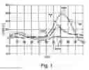 Fig. 02 - Orthopedic device