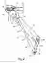 Fig. 06 - Orthopedic device