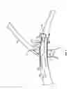 Fig. 07 - Procedures for vascular occlusion