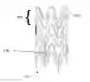 Fig. 01 - BRANCHED POLYHYDROXYALKANOATE SYSTEMS FOR BIORESORBABLE VASCULAR SCAFFOLD APPLICATIONS