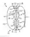 Fig. 01 - System and methods for internalization of external components of adjustable intragastric balloon