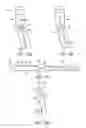 Fig. 06 - System and methods for internalization of external components of adjustable intragastric balloon