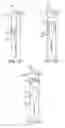 Fig. 07 - System and methods for internalization of external components of adjustable intragastric balloon
