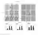 Fig. 07 - METHODS AND COMPOSITIONS FOR TREATING KIDNEY DISORDERS