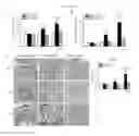 Fig. 09 - METHODS AND COMPOSITIONS FOR TREATING KIDNEY DISORDERS