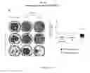 Fig. 22 - Use of common γ chain cytokines for the visualization, isolation and genetic modification of memory T lymphocytes