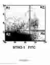 Fig. 02 - Methods of treating or preventing respiratory conditions