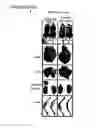 Fig. 03 - Polypeptide vaccine